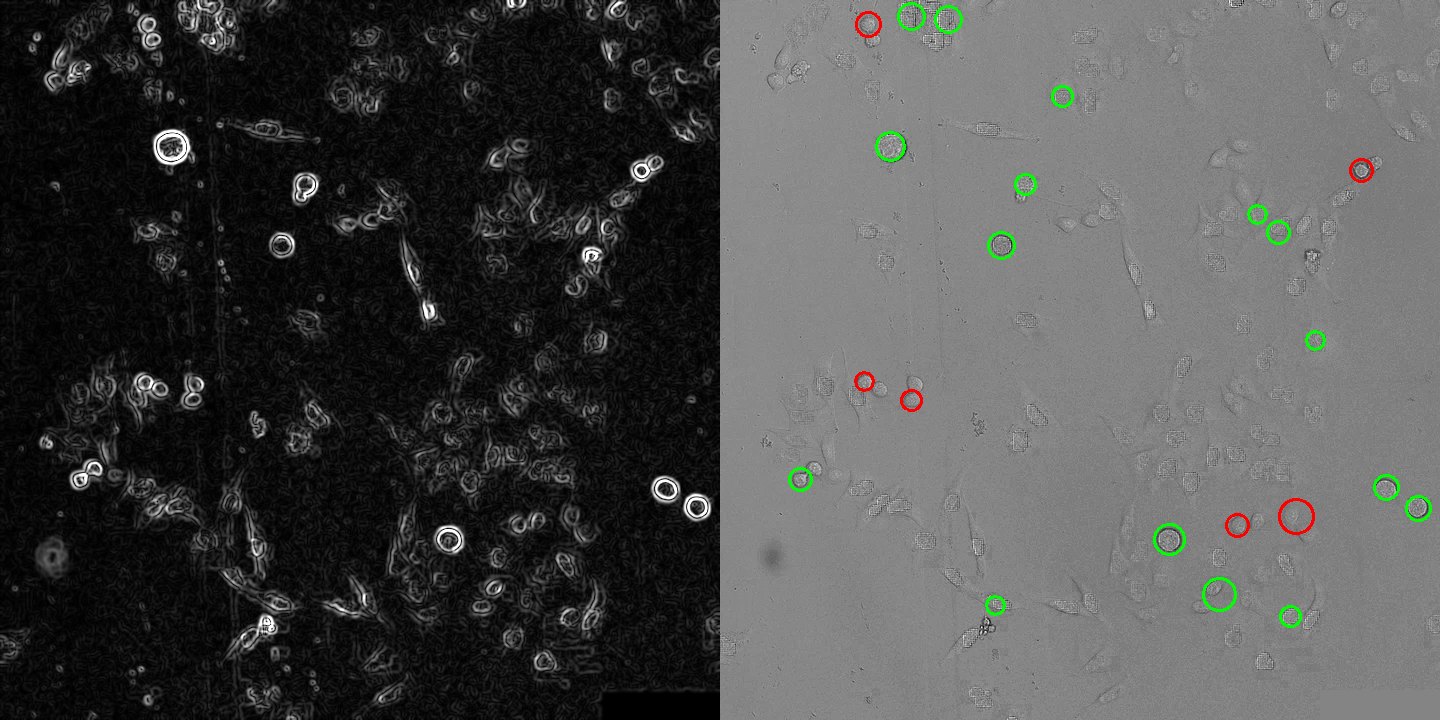 Left: edge-strength image where rounded cells appear as bright double rings. Right: transmitted-light image with detected circles marked.